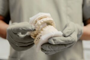 Protesi dentaria a Pistoia con modello dentale per riabilitazione del sorriso